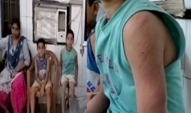 आरा : होमवर्क नहीं बनाया तो ट्यूटर बन गई जल्लाद! पीटकर पहुंचा दिया अस्पताल...